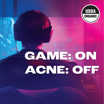 Image of a silhouette of a person wearing gaming headphones, sitting in front of a computer with a vivid blue and pink backlighting, suggesting a gaming environment. Bold white text in the foreground reads 'GAME: ON ACNE: OFF,' symbolizing the effectiveness of HYP Daily Repairing Mist for gamers. The 'USDA ORGANIC' seal is in the upper right corner, implying the product's organic certification.